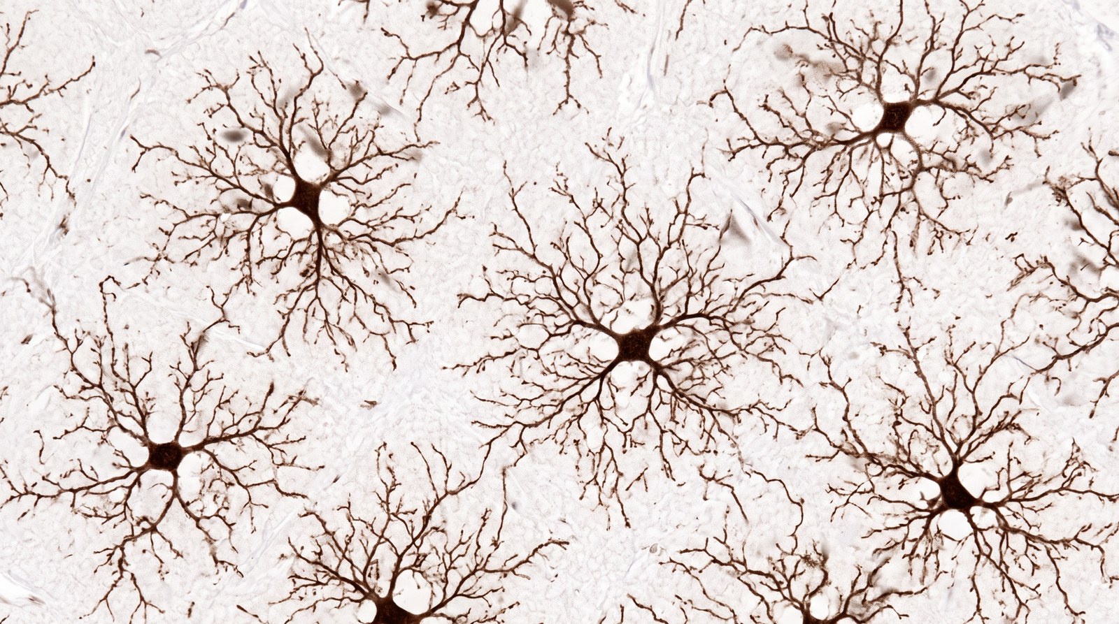 Stylised hero illustration for the glossary entry on Microglia